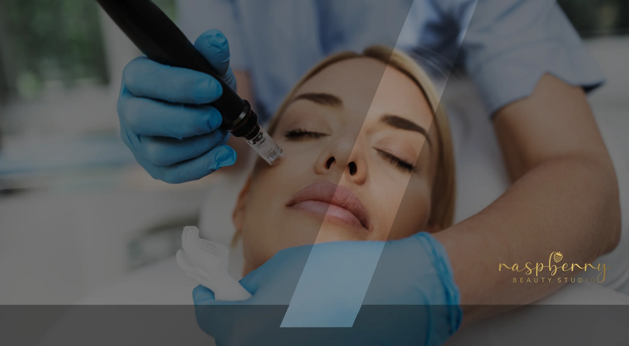 microneedling microneedling